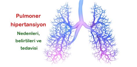 primer pulmoner hipertansiyon nedenleri